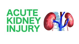 Acute Kidney Injury AKI  USMLE [upl. by Ieppet224]