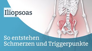 Iliopsoas Schmerzen Triggerpunkte und deren Aktivierung [upl. by Perkoff7]