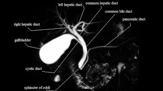 MRCP planning and protocol [upl. by Dogs877]