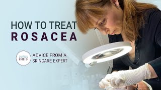 How to Treat Rosacea  Advice from a Skincare Expert [upl. by Antonetta221]