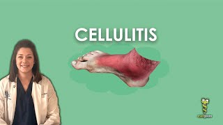 Cellulitis [upl. by Berkly]