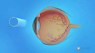 Peripheral Vision and Central Vision in the Retina [upl. by Cassiani]