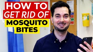 Mosquito Bites  How To Get Rid Of Mosquito Bites [upl. by Nrobyalc]