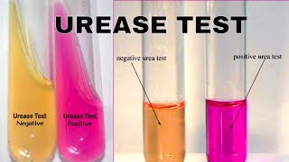 Urea Hydrolysis Urease Test [upl. by Ennayhc691]