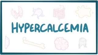 Hypercalcemia  causes symptoms diagnosis treatment pathology [upl. by Notsud]