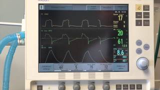 Ventilators  Part 1 Biomedical Engineers TV [upl. by Dachia902]