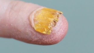 NASTY NAIL FUNGUS [upl. by Asilad]