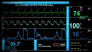 Sonido De Un Hospital [upl. by Boigie]