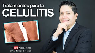 TRATAMIENTOS PARA LA CELULITIS ¿Como eliminar celulitis Dr Marino Dermatologo [upl. by Nwahsat]