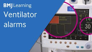 What is Mechanical Ventilation  Ventilators EXPLAINED [upl. by Adalie467]