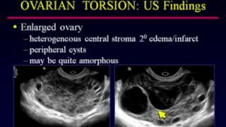 What is Ovary Body Type  Dr Berg [upl. by Beatriz]