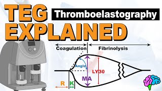 TEG Explained  Understanding the Thromboelastography [upl. by Jaquenette]