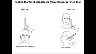 Interpreting the WeberRinne Tests EXPLAINED [upl. by Kcirdneh]