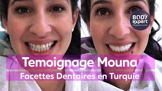 Témoignage Facettes Dentaires Turquie Mouna [upl. by Zeke]