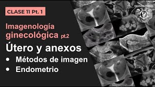 111  Imagen Ginecológica Métodos de estudio y patología endometrial [upl. by Rolf]