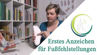 Erstes Anzeichen für Fußfehlstellungen [upl. by Mcripley125]