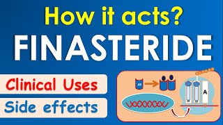 Finasteride  How it acts  Mechanism side effects amp uses [upl. by Giza]