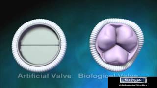 Biological Aortic Heart Valve  Animation Video [upl. by Yldarb971]