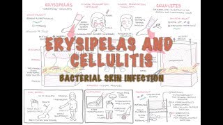 Bacterial Skin Infection  Cellulitis and Erysipelas Clinical Presentation Pathology Treatment [upl. by Daphene]