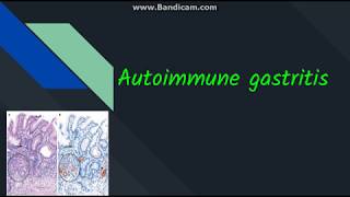 Autoimmune gastritis [upl. by Anirbac761]