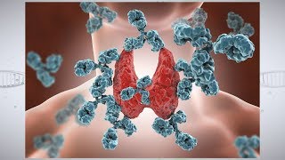 What Is Chronic Granulomatous Disease [upl. by Atsillac]