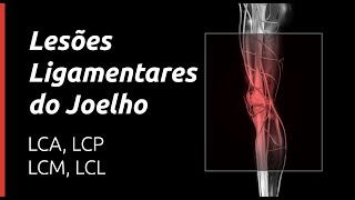 Saiba tudo sobre Lesões ligamentares joelho [upl. by Laundes788]