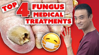 4 MEDICAL treatments to get rid of toenail fungus  Holistic Toenail Fungus Cures Part 3  Dr Kim [upl. by Stauder]