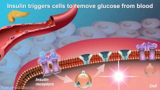 Understanding Type 2 Diabetes [upl. by Alegnaed481]