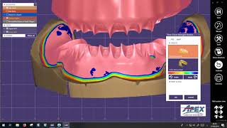 complete Denture exocad [upl. by Aracaj]