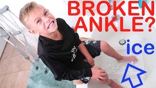 BROKEN ANKLE Super Cold Ice Bath [upl. by Ailssa]