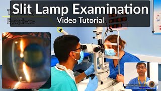 Slit Lamp Exam Tutorial  Part 1 [upl. by Ahmar978]