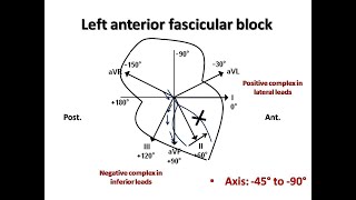 Femoral Nerve and Fascia Iliaca Blocks [upl. by Annayoj]