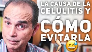 Episodio 20 La Causa De La Celulitis Y Como Evitarla [upl. by Eleumas]