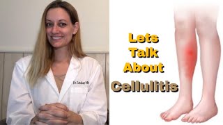 CELLULITIS Everything You Need To Know Symptoms Cause Risk Factors Treatment Prevention [upl. by Nnyl20]