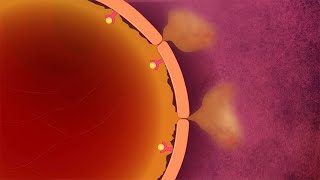 Plasma Leakage [upl. by Klaus]