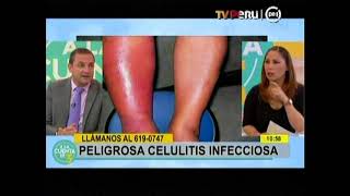 Celulitis infecciosa Dr Carlos Echevarria [upl. by Lymann]