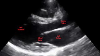 Echocardiogram Parasternal Long Axis View  Loop [upl. by Monafo]