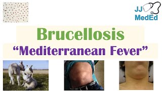 Brucellosis Mediterranean Fever  Transmission Pathogenesis Symptoms Diagnosis Treatment [upl. by Alfredo25]