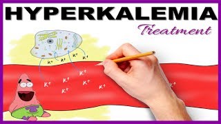 Hyperkalemia with ECG changes Treatment  Mnemonic Series 15 [upl. by Winograd]