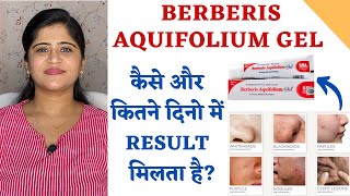 Berberis Aquifolium Gel for Acne and Scars ॥ कैसे और कितने दिनो में Result मिलता है [upl. by Kessiah]