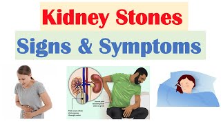 Nephrotic Syndrome 101  Signs Symptoms Pathophysiology  National Kidney Foundation [upl. by Ledarf]