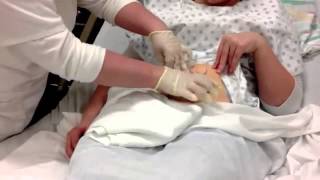 Colostomy Care Teaching Video [upl. by Yekcin13]