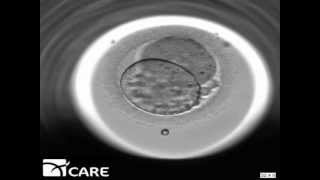 Time Lapse Embryo Imaging [upl. by Geller]