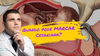 Quando pode Marcar cesariana  Cesárea agendada [upl. by Feeney935]