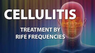 Cellulitis Bacterial infection  RIFE Frequencies Treatment  Energy amp Quantum Medicine [upl. by Anot]