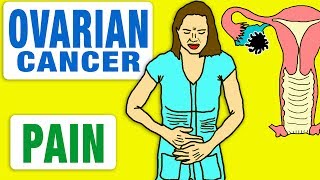 Ovarian Cysts Causes Symptoms amp Natural Treatment – DrBerg [upl. by Prevot379]