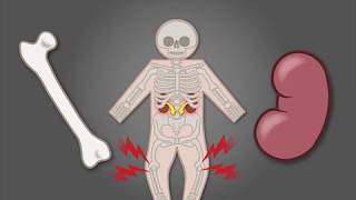 Neonatal Resuscitation Overview amp Apgar Score – Pediatrics  Lecturio [upl. by Ginni881]