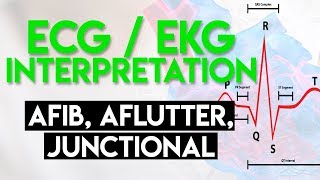 Afib Aflutter Junctional Arrhythmias  ECG EKG Interpretation Part 4 [upl. by Blank]