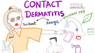 Contact Dermatitis [upl. by Alilak]