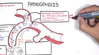 Malaria Pathophysiology [upl. by Tenrag]